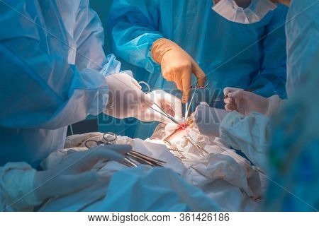 Close-up, The Hands Of Pediatric Surgeons And An Assistant Operating A Small Patient With Behind-the