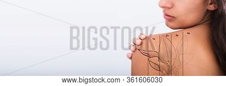 Laser Tattoo Removal From Tattooed Woman Shoulder