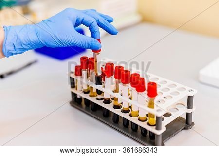 Blood Samples For Research In Microtubes. Testing In Laboratory. Chemical Research. Prevention. Pneu