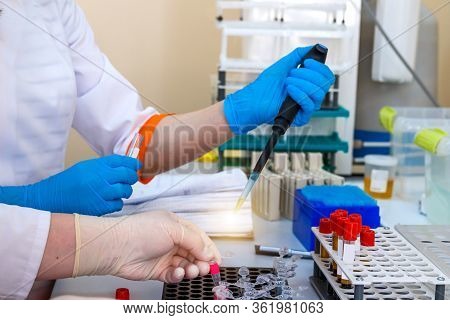 Hands Of Laboratory Assistant In Gloves Analyzing Blood Sample. Prevention. Pneumonia Diagnosing. Co