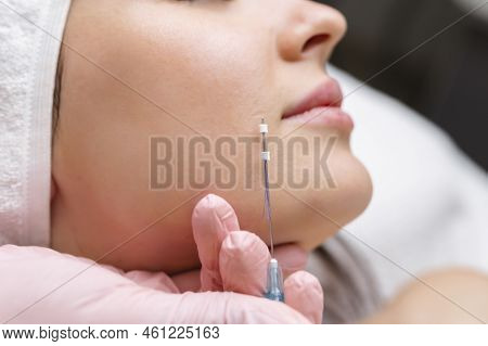 Face Lifting Pdo Suture Operation. Innovative Technique Of New Thread Lift, Cosmetologist Preparing 