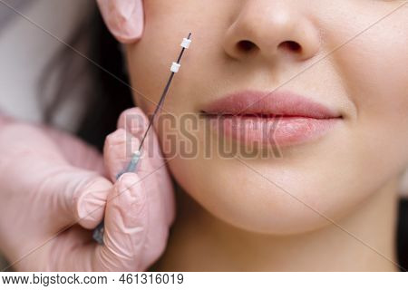 Face Lifting Pdo Suture Operation. Innovative Technique Of New Thread Lift, Cosmetologist Preparing 