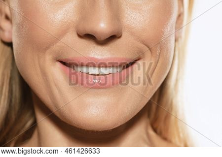 Closeup Of Female Lips, Cheeks And Nose Isolated Over White Studio Background. Concept Of Cosmetolog