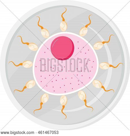 Artificial Insemination Illustartion Vector In Flat Style. Ovary Cell In Petri Dish.