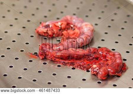 Close-up Of Pyometra - Uterus Inflammation After Surgical Operation To Remove Uterus With Pus At The