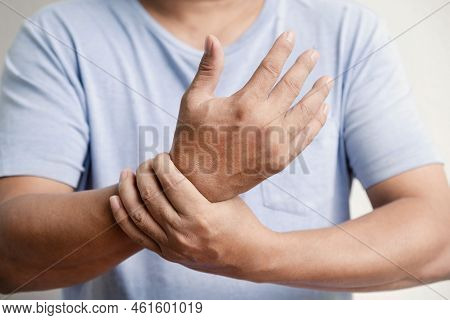 Man Hand Massage Physiotherapy Wrist Is Sore And Numb, Exhausted, Tingling. Guillain-barre Syndrome,