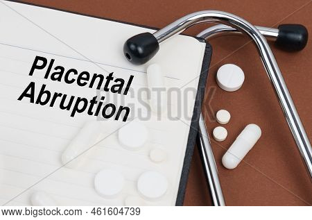 Medical Concept. On A Brown Surface Lies A Stethoscope, Pills And A Notepad With The Inscription - P
