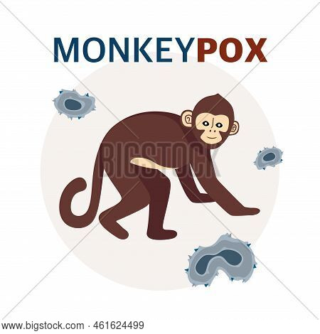 Monkey Pox Virus Poster To Inform About The Pandemic And Spread Of The Disease Images Of Human Virus