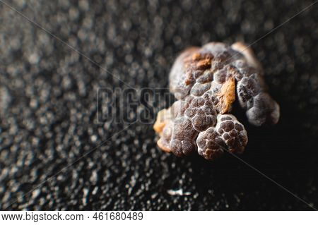 Close-up Of A Kidney Stone. Neoplasm Urolithiasis Of The Kidneys. Nephrolithiasis - Closeup Shot Of 