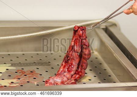 Doctor's Hand Holds The Dog's Pyometra Uterus With Surgical Forceps. Uterus Inflammation After Opera