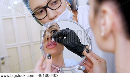 Medical Office, Beautiful Woman Looking In The Mirror, Doctor Wipes Patient Lips With A Sterile Napk