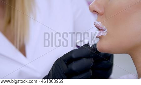 Close-up, A Cosmetology Clinic, Doctor Applies Anesthesia On Patients Lips, An Anesthetic Before Inj