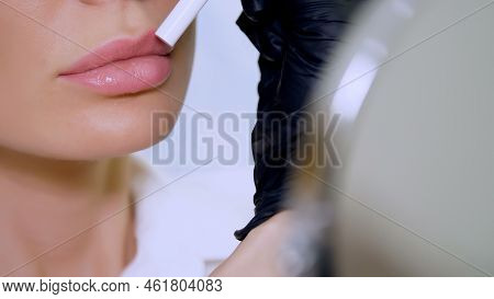 Clinic, A Beauty Salon, A Large Plan Of The Lips, The Doctor Shows The Patient A Lip Zone For Inject