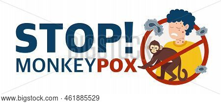 Monkey Pox Virus Poster To Inform About The Pandemic And Spread Of The Disease Images Of Human Virus