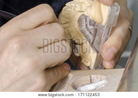 Dental Technician Putting A Ceramic Tooth In A Dental Cast Model.