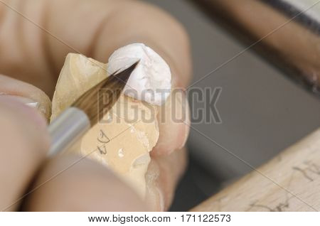 Dental Technician Putting A Ceramic Tooth In A Dental Cast Model.