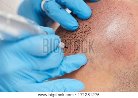 professional tattooist making permanent make up tricopigmentation