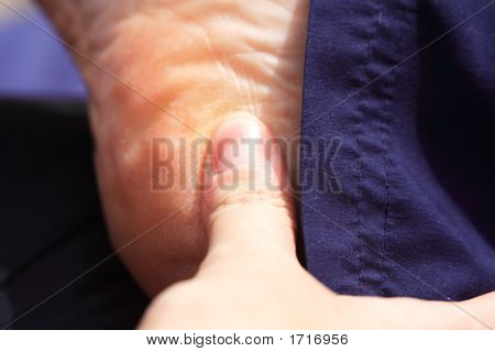 Tiefenmassage an der Ferse des Fußes
