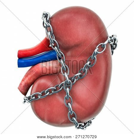 Kidney Pain Concept. Human Kidney With Chain. 3d Rendering Isolated On White Background