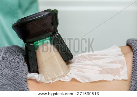 Woman Getting Cryolipolysis Fat Treatment Procedure In Professional Cosmetic Cabinet Or Spa Center