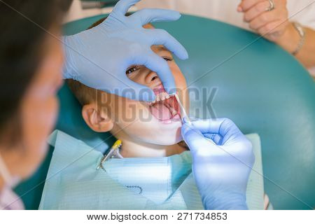 Dentist Is Treating A Boys Teeth. A Small Patient In The Dental Chair Smiles. Dantist Treats Teeth. 