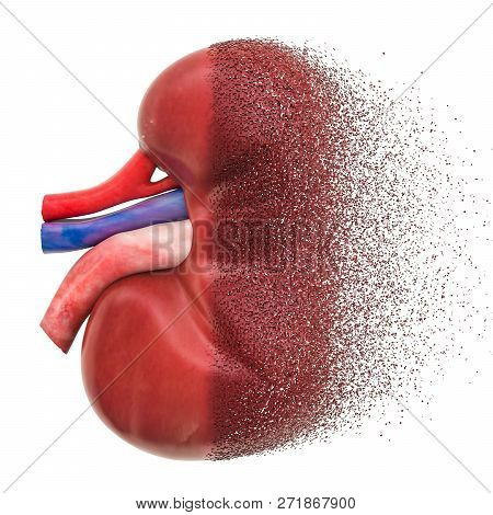 Chronic Kidney Disease, Kidney Failure Concept. 3d Rendering Isolated On White Background
