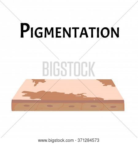 Pigmentation On The Skin. A Pigmented Spot On The Skin Of The Face. Illustration