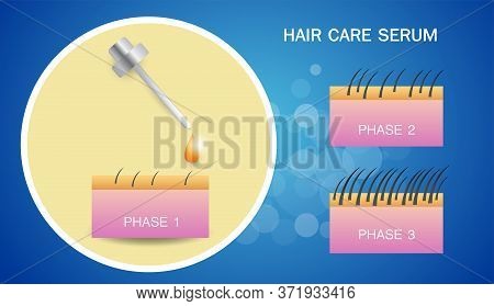 Hair Care Serum, Beauty And Vector Design.
