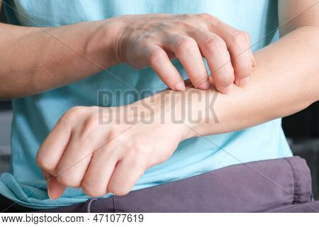 The Man's Hands He Uses His Hands To Scratch His Back Because Of Dermatitis And Itch Sensation.