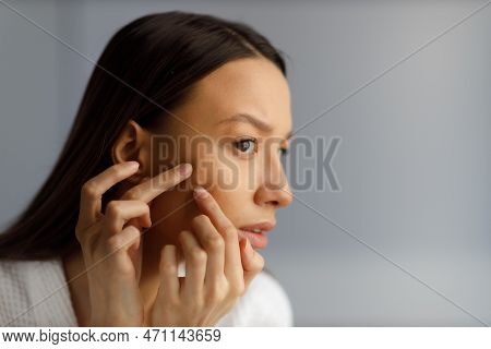 Attractive Upset Young Woman In White Bathrobe Examines Pimples On Her Face. Problematic Skin On The