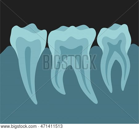 X Ray Image Of Teeth Dental Equipment Medical Surgery Radiogram Photo Vector Flat Illustration
