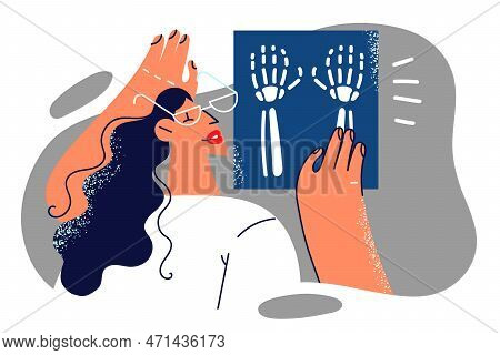 Woman Doctor Examines X-ray Shot Of Hands Of Person Injured Or Suffering From Carpal Tunnel Syndrome