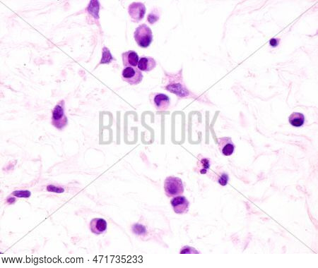 Plasma Cells Are B Lymphocytes Activated By The Presence Of Antigens That Secrete Large Quantities O