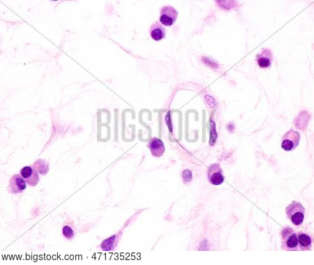 Plasma Cells Are B Lymphocytes Activated By The Presence Of Antigens That Secrete Large Quantities O