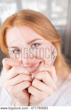 Dental Care.smiling Girl With Red Hair Holding Heart Shaped Aligners