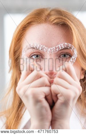 Dental Care.smiling Girl With Red Hair Holding Heart Shaped Aligners