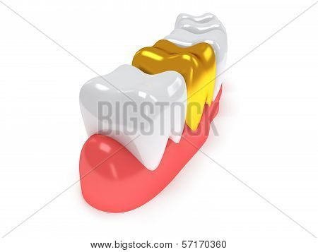 Teeth on gingiva isolated on white back.