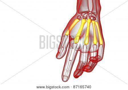 3D Render Medical Illustration Of The Metacarpal Bone