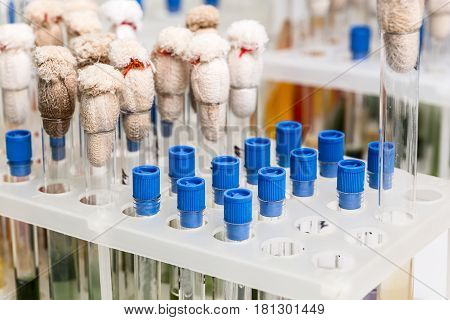 Test tubes arranged on medical trolley. Medical research
