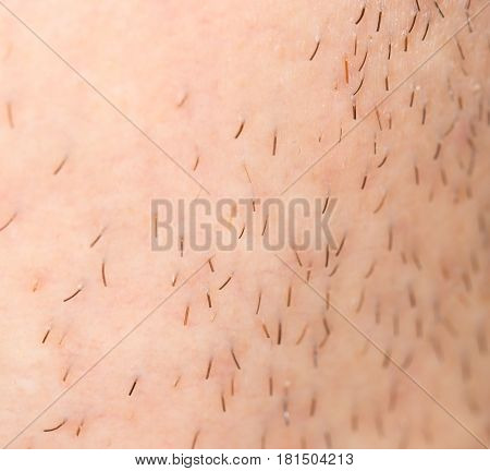 bristles on the skin. close-up . A photo