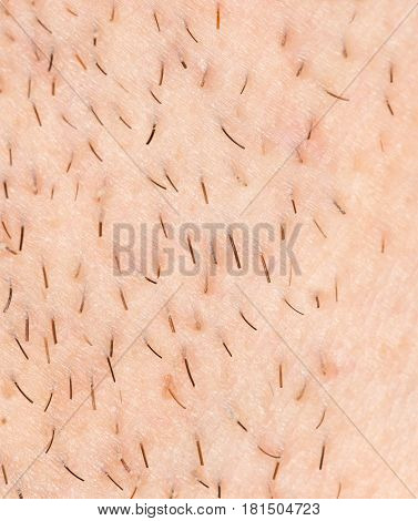 bristles on the skin. close-up . A photo