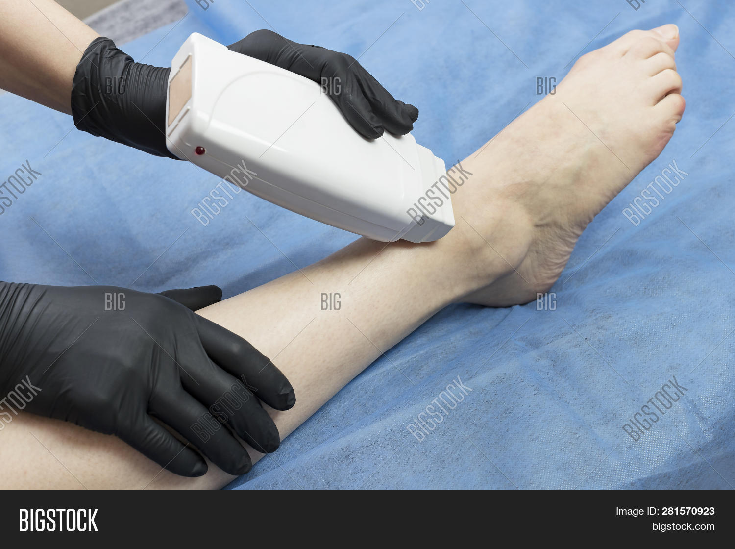 Process Depilation Image & Photo (Free Trial) Bigstock