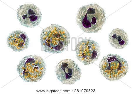 Bacteria Neisseria Gonorrhoeae Inside Neutrophils, Gonoccoccus, Diplococci That Cause Sexually Trans