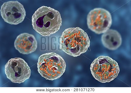 Bacteria Neisseria Gonorrhoeae Inside Neutrophils, Gonoccoccus, Diplococci That Cause Sexually Trans
