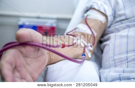 Hemodialysis In People On The Equipment