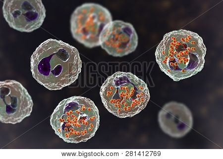 Bacteria Neisseria Gonorrhoeae Inside Neutrophils, Gonoccoccus, Diplococci That Cause Sexually Trans