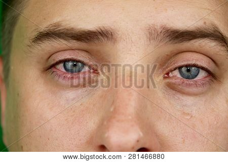 Tears In Eyes Of Crying Adult Man. Green Background. Chromakey