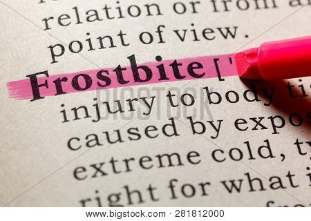 Fake Dictionary, Dictionary Definition Of The Word Frostbite. Including Key Descriptive Words.