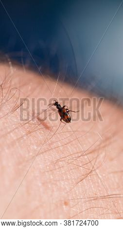 A Small Black Insect Sits On A Hand Close-up. Insect In The Palm Of Your Hand. Close-up