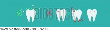 Sick, Destroyed Teeth: Dental Plaque, Caries, Chips, And Cracks And Healthy Clean Teeth. Dental Care
